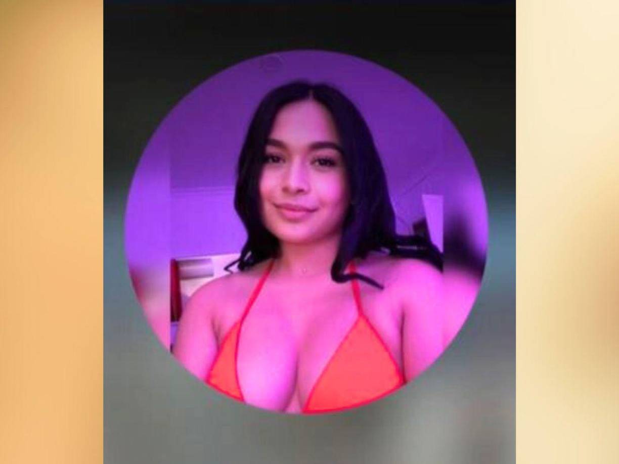 La víctima, quien había regresado recientemente de España con la intención de mejorar su apariencia física, se sometió a una lipoescultura en un establecimiento no certificado. 