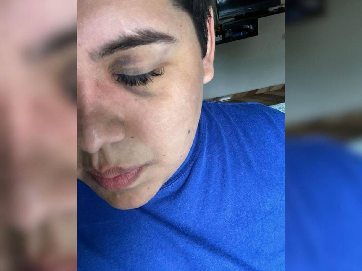 ”Por si fuera poco uno de ellos abusó de mi mientras me apagaba sus cigarrillos en la frente y cabello”, explicó.