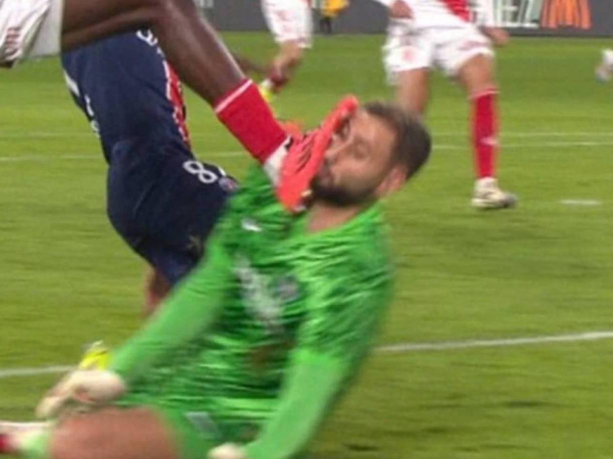 Gianluigi Donnarumma, portero del París Saint Germain y titular en los últimos cinco partidos de su equipo, fue cambiado por lesión en el minuto 20 del partido de este miércoles de la liga francesa contra el Mónaco.