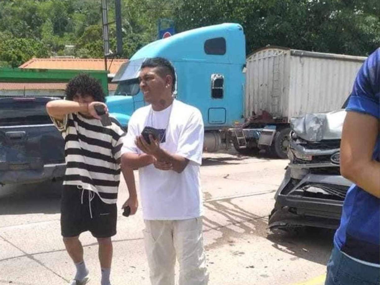 Y aunque en algunas fotos se le ve sujetando su brazo y con aparente rostro de dolor, se desconoce el estado de salud del tiktoker. 