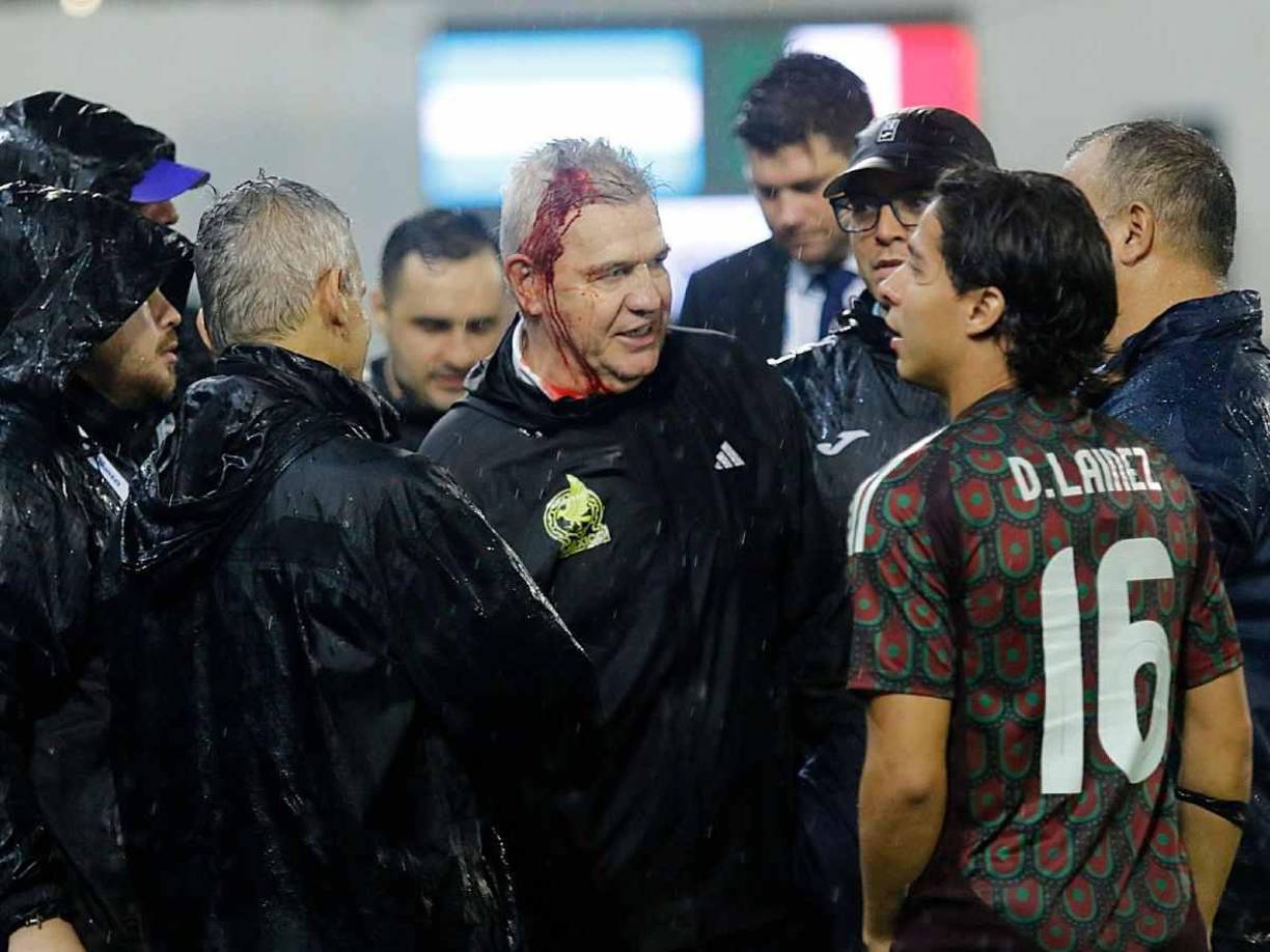 Tras el final del juego, el entrenador Vasco Aguirre de México fue agredido con una lata de cerveza y eso ha provocado indignación en los mexicanos.