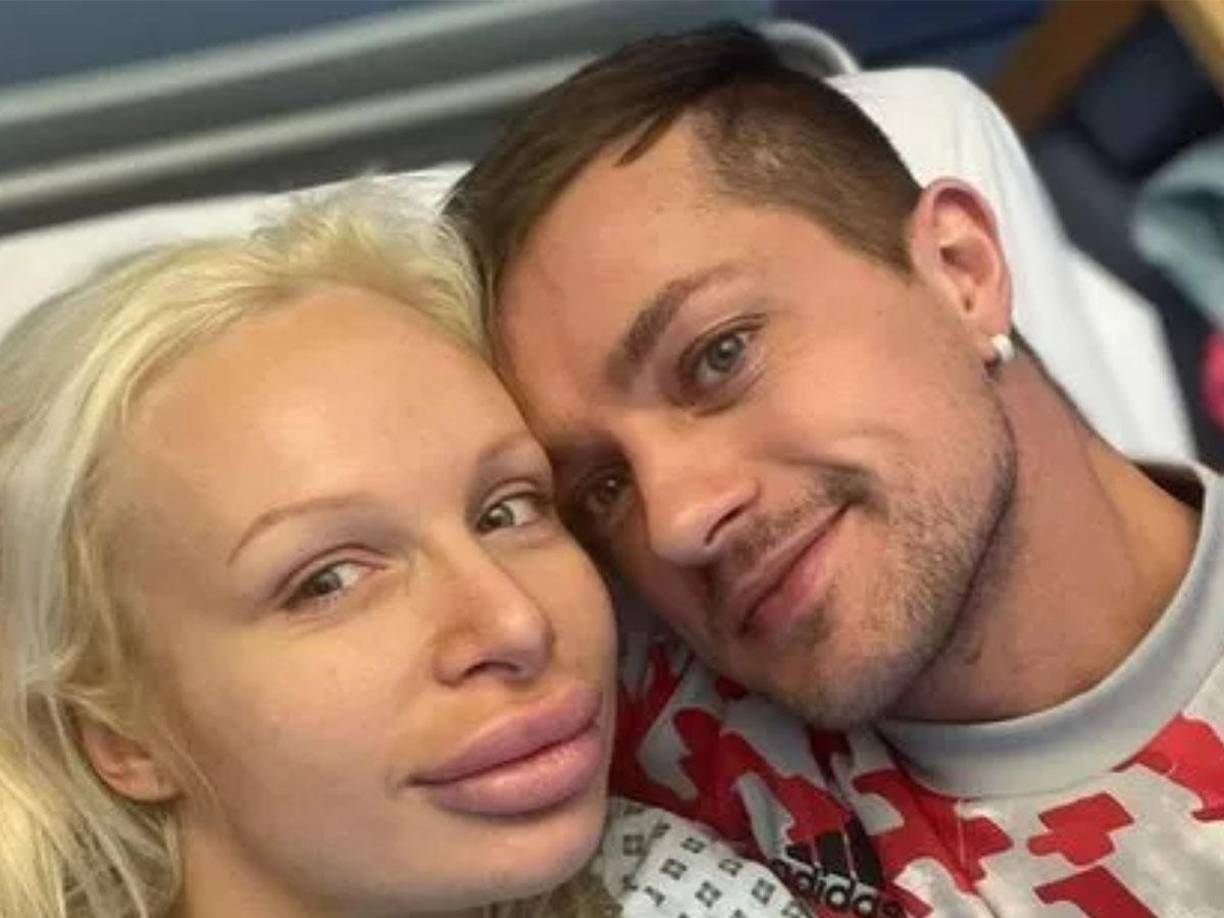 Anderson mantenía una relación de noviazgo con el también actor de cine para adultos Oliver Spedding, quien también fue encontrado muerto de forma repentina hace apenas dos semanas, el pasado día 17 de noviembre.