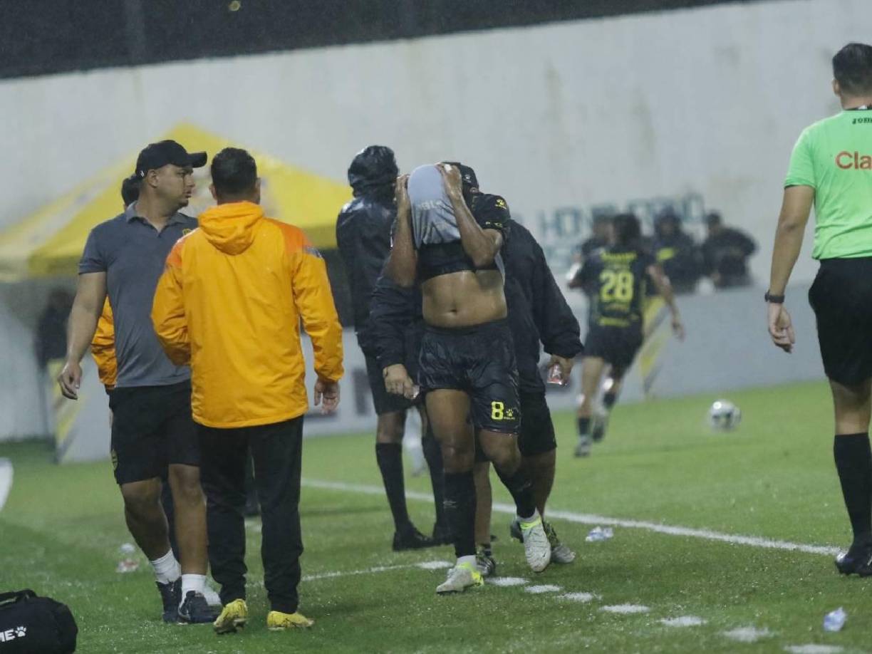 Sobre el final del primer tiempo, Real Espana sufrió un duro golpe con la salida de Bryan Acosta.