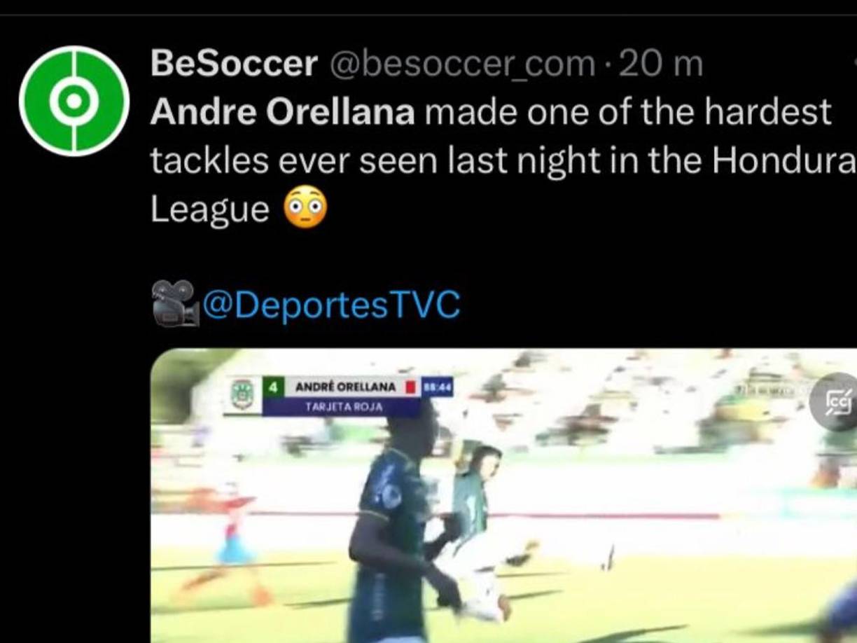 Argentinos y españoles reaccionan asombrados por la falta de André Orellana