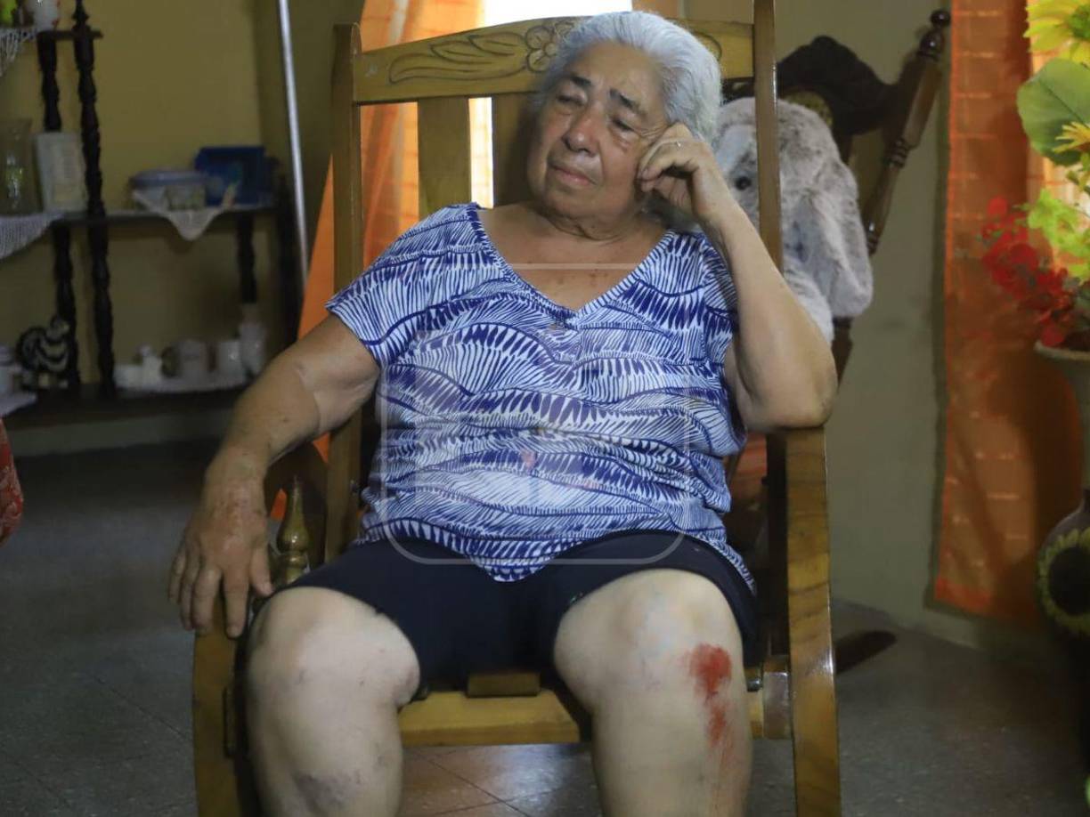 “De hecho, está establecido una ley de que debería de bajarse y ver en qué manera puede salvaguardar la vida de la persona que él acaba de golpear. Él no lo hizo, se dio a la fuga alegando que por sistema, por seguridad y yo no vi gente ahí como para que él se sintiera amenazado”, dijo un hijo de doña María Figueroa.