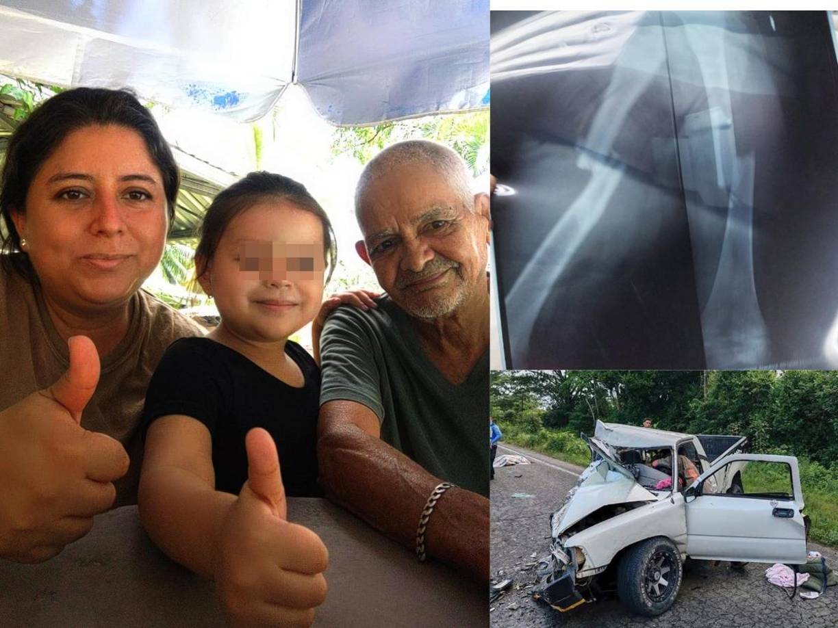 La pequelña Fernanda fue la única sobreviviente de un accidente en el que murió su mamá Vanessa y su bisabuelo Luis Alonso Cruz.