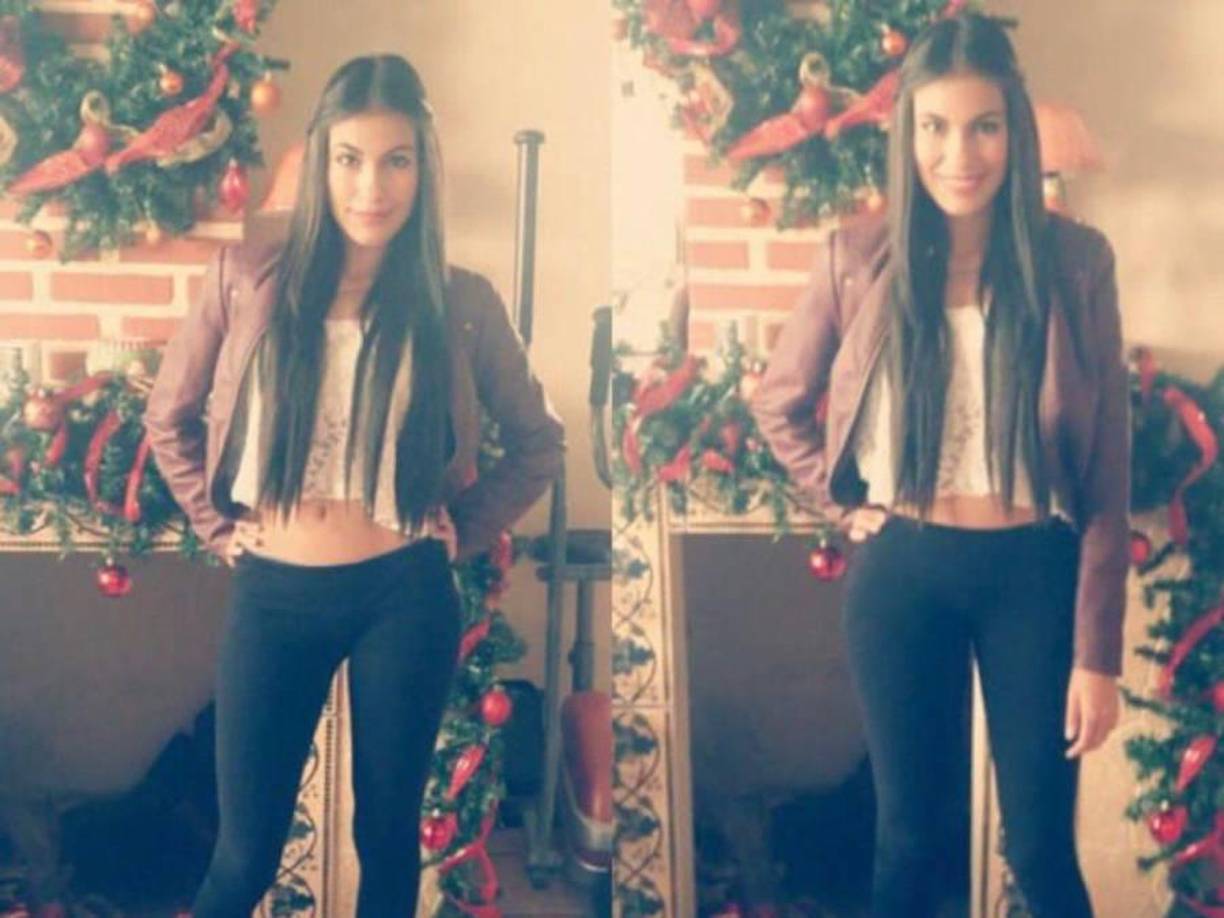 Alejandra se realizó una lipo de alta definición, reducción de cintura, levantamiento de glúteos, más caderas y más piernas.