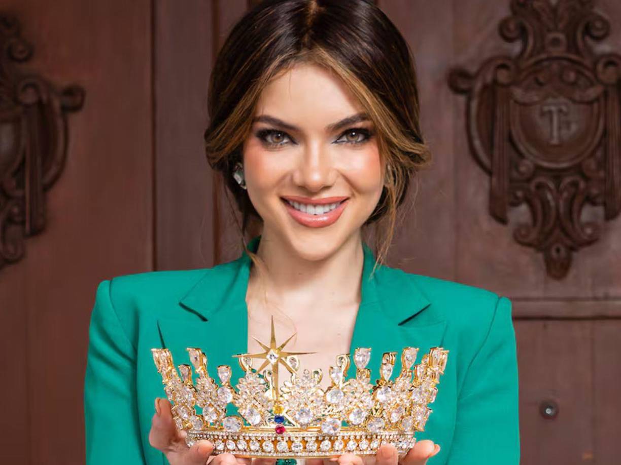 Después de enfatizar que no es alopecia, la candidata ecuatoriana explicó que comenzó a usar pelucas por recomendación de su doctora. 