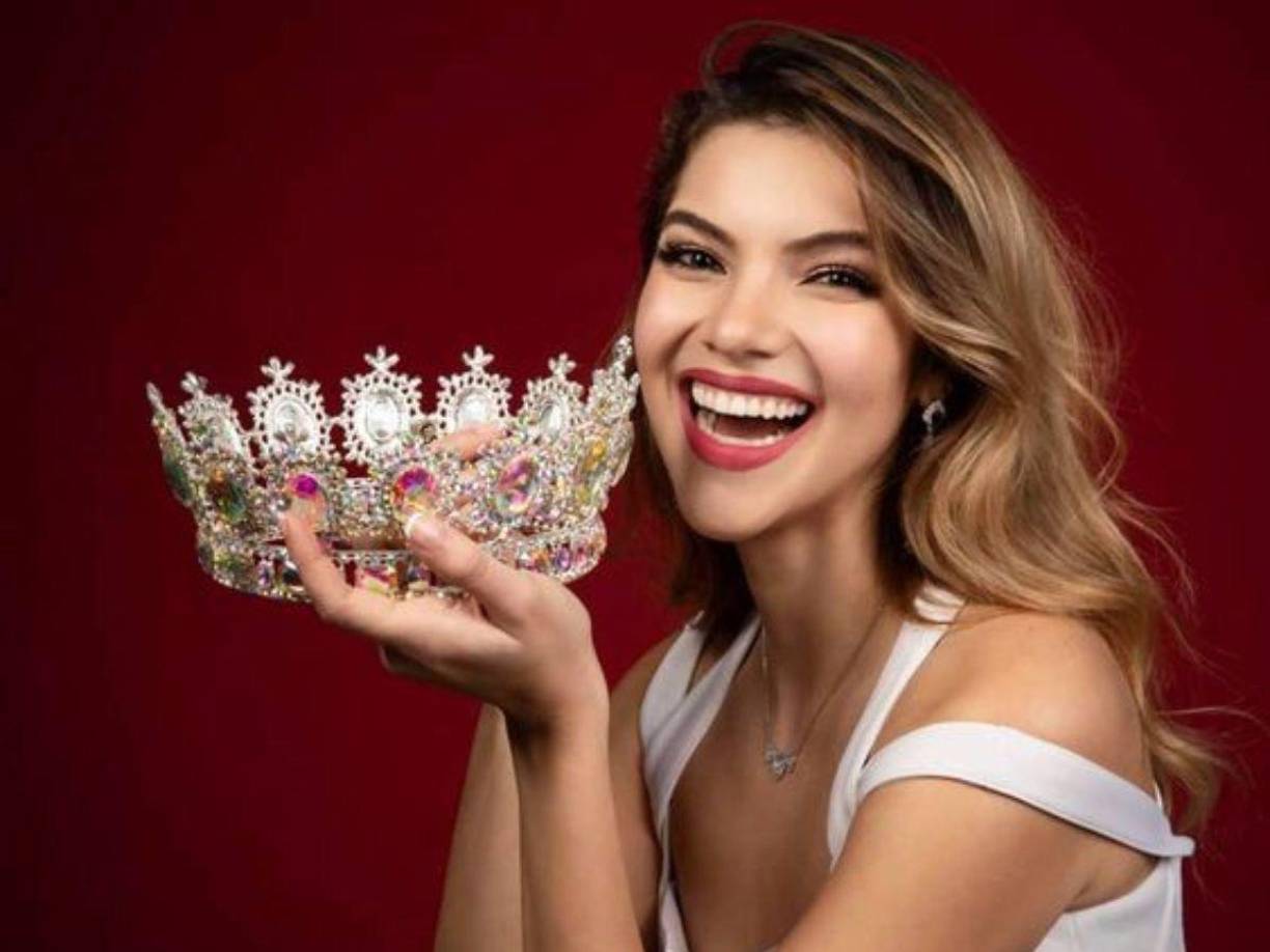 Hay personas que se ve de diferentes maneras, hay personas que no se pueden levantar de la cama, otras tiene altos niveles de estrés y no pueden hacer actividades físicas, otras tienen la piel super seca, a mi se me refleja en la perdida de cabello, a otras no”. 