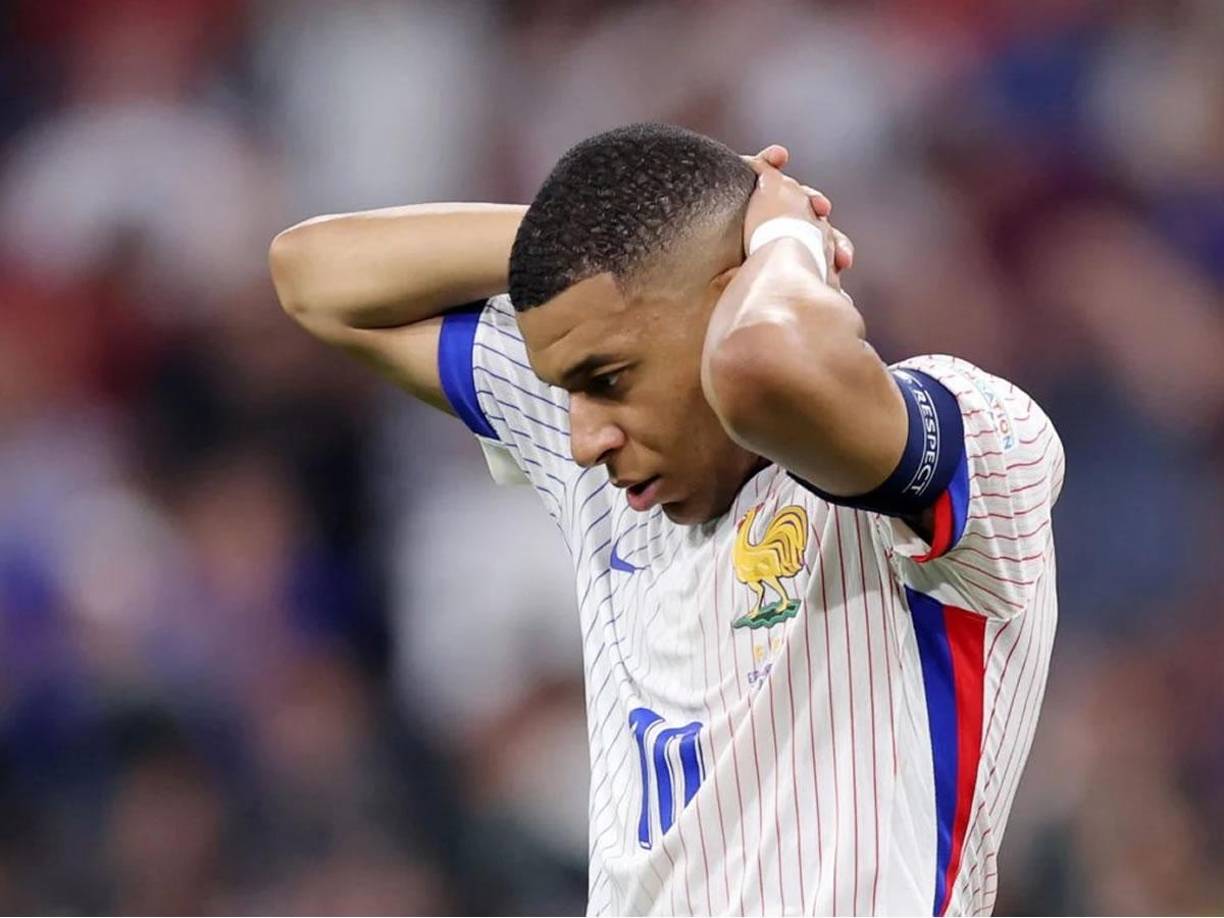 Deschamps afrontó una situación embarazosa ante las numerosas preguntas sobre la ausencia del capitán, que tuvo dificultades para explicar.