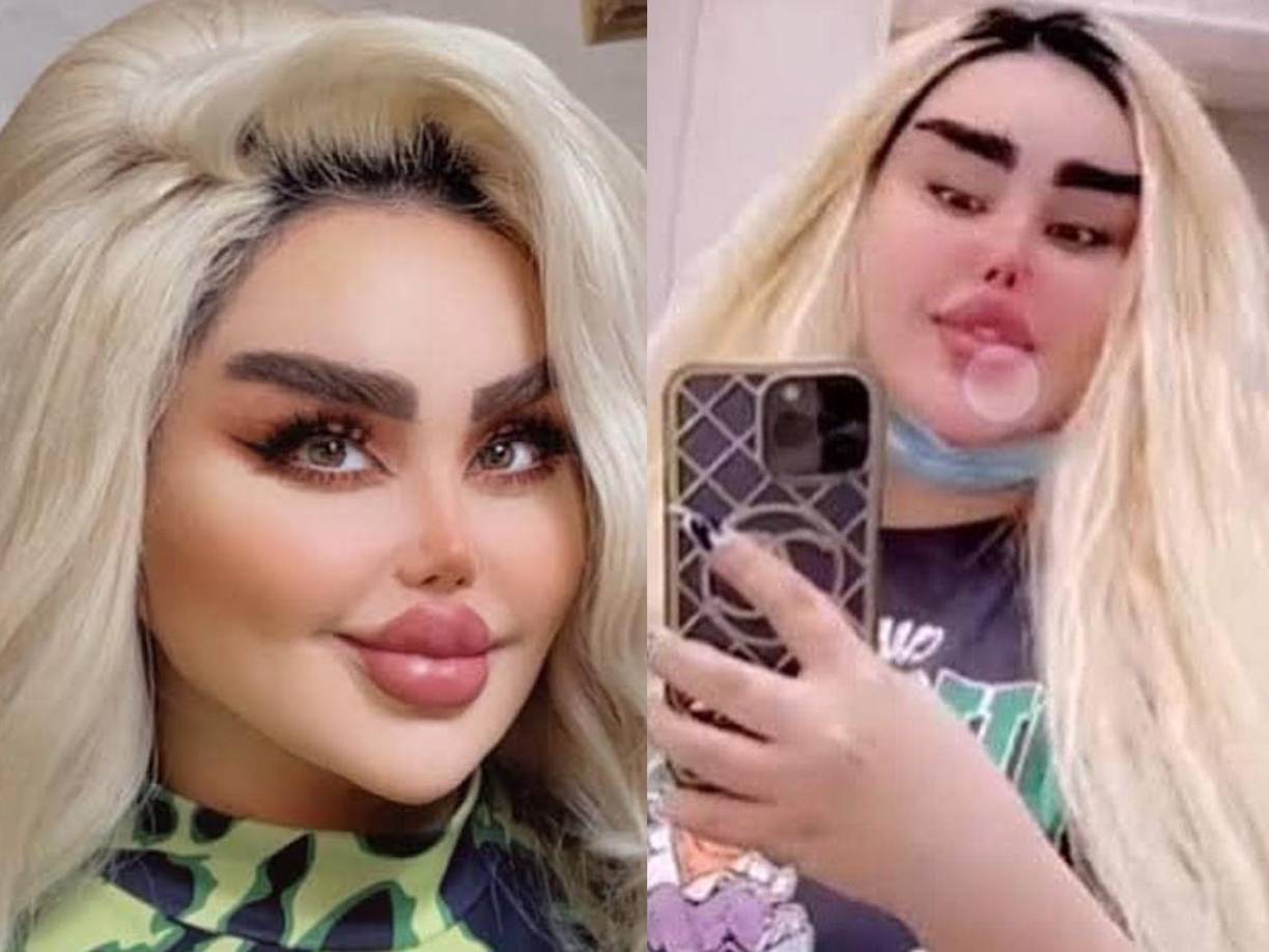 Dalia saltó a la fama gracias a que protagonizó obras de teatro y programas de televisión, pero por lo que se ha robado la atención de las cámaras en los últimos años es por su radical cambio para ser coronada como la “Barbie iraquí”.