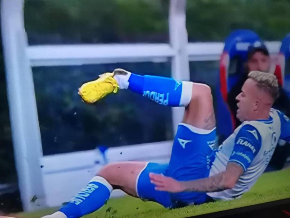 Gustavo Ferrareis sufrió una lesión de tobillo cuyas imágenes son impactante.