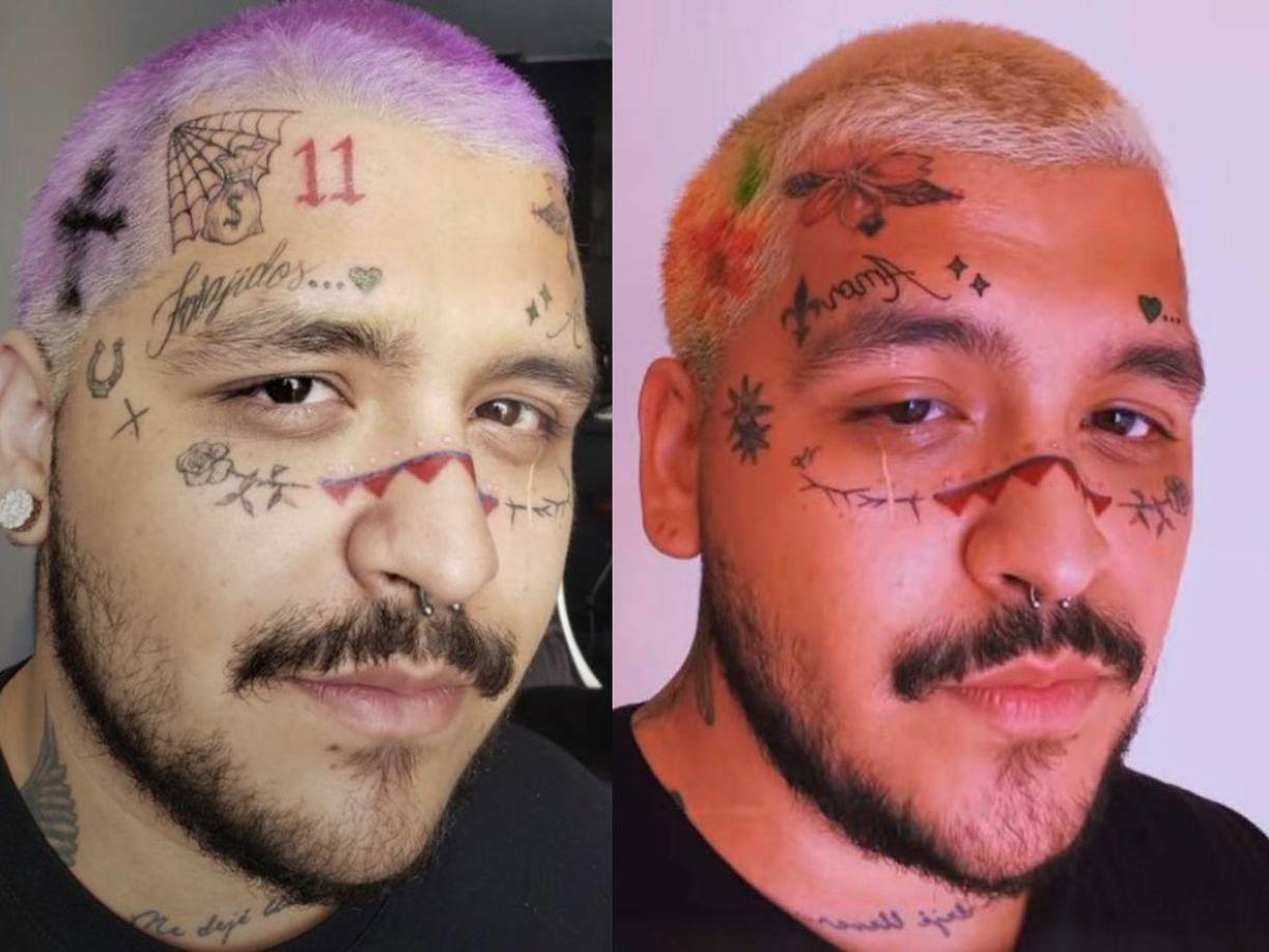 Después de hacerse varios tatuajes en el rostro, Christian Nodal se sometió a un procedimiento para removerlos.