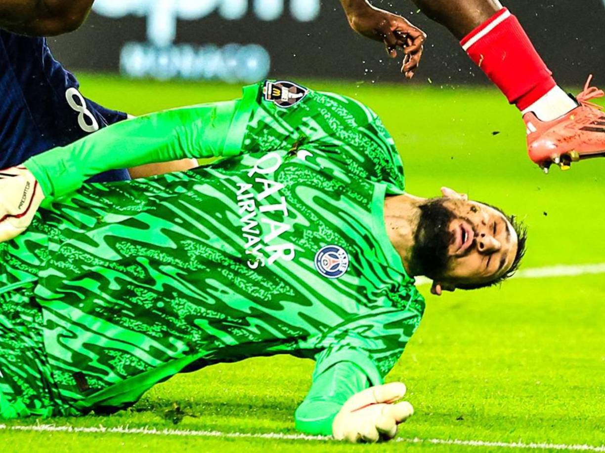 Gianluigi Donnarumma sufrió este miércoles 18 de diciembre una terrible lesión que ha provocado diversos comentarios a nivel mundial.
