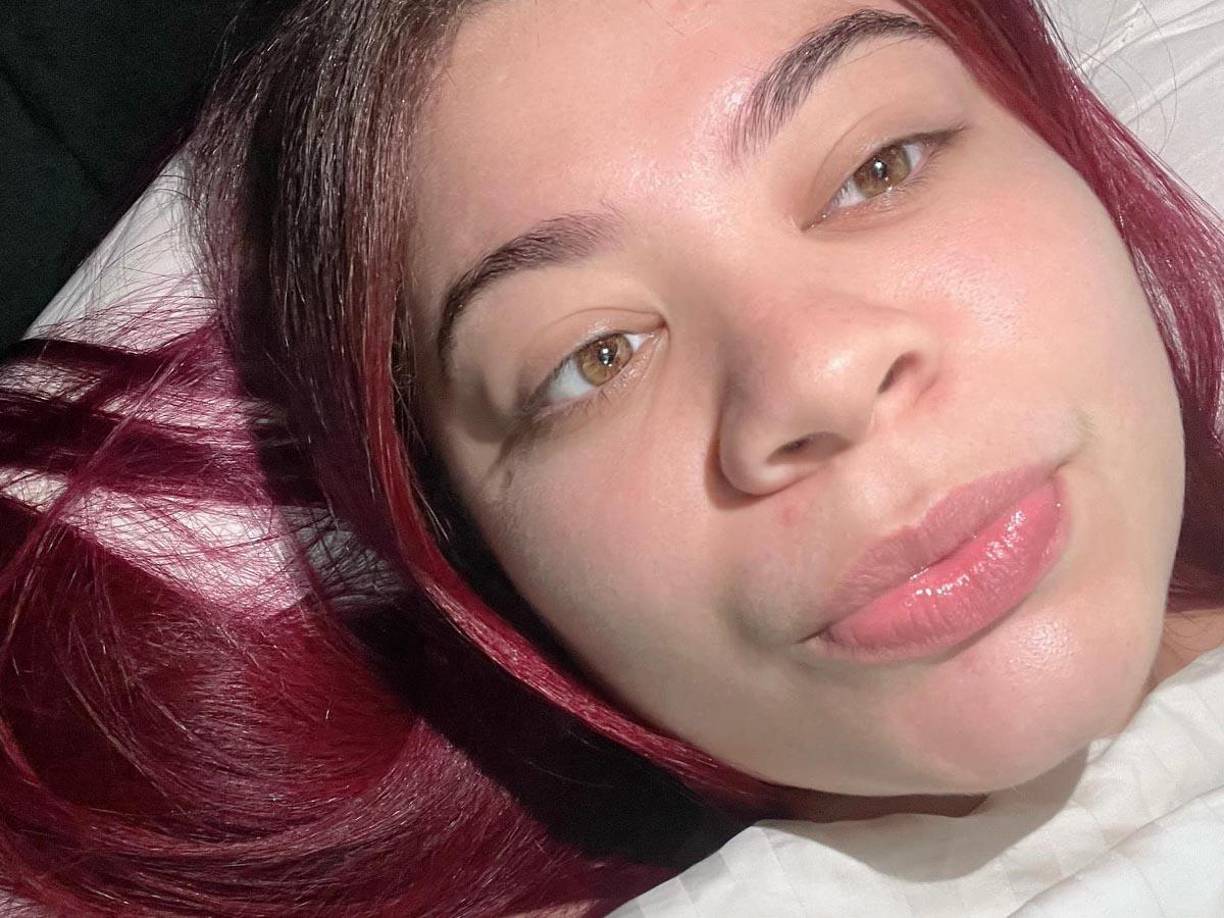 Tras las cirugías, Pamela fue dada de alta casi de inmediato, pero su estado de salud se deterioró rápidamente. 