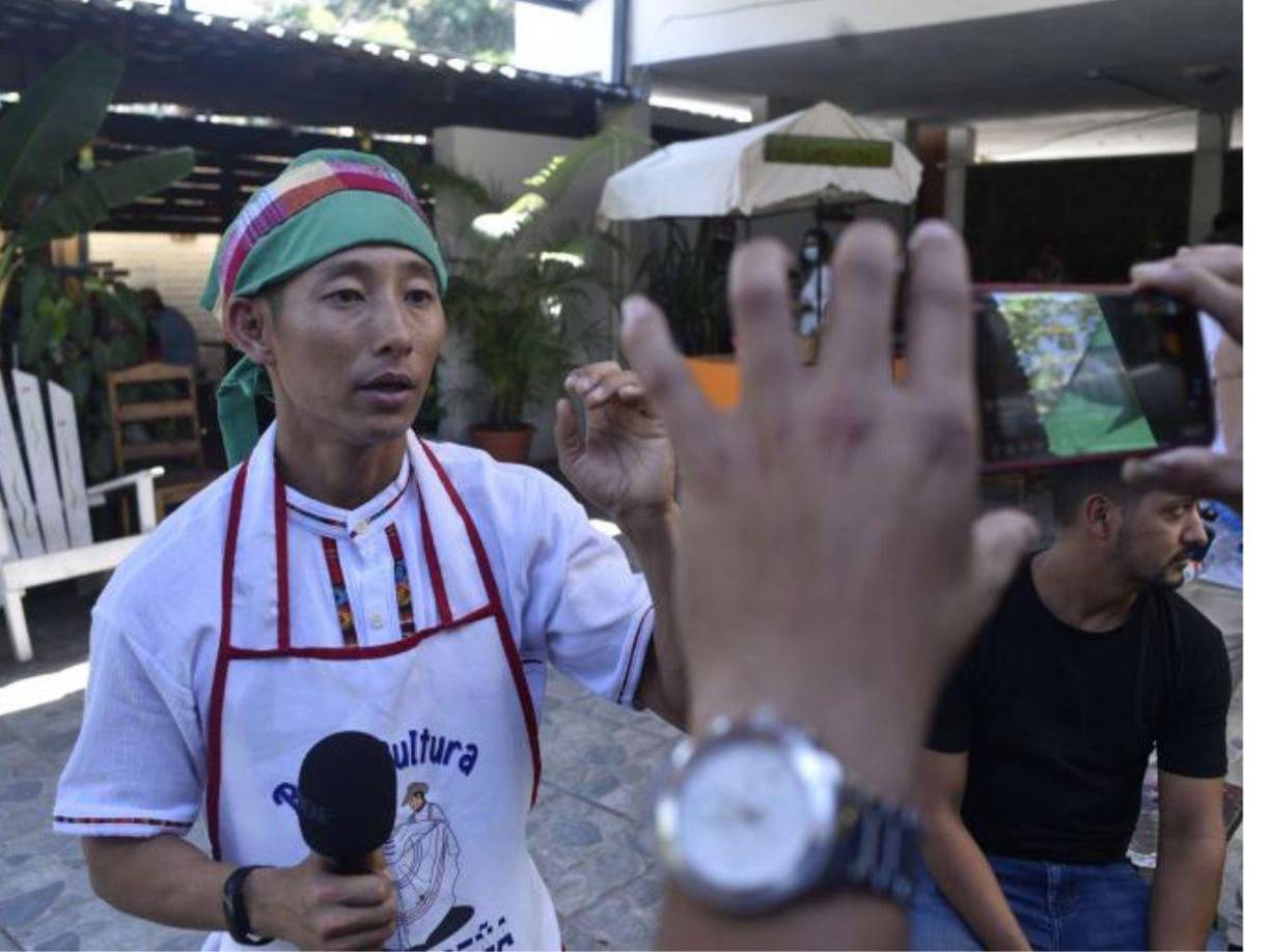 Shin Fujiyama, el influencer de Honduras, transmitio a través de las redes sociales para que la gente llegara al restaurante “La Campesina de las Riguas”.