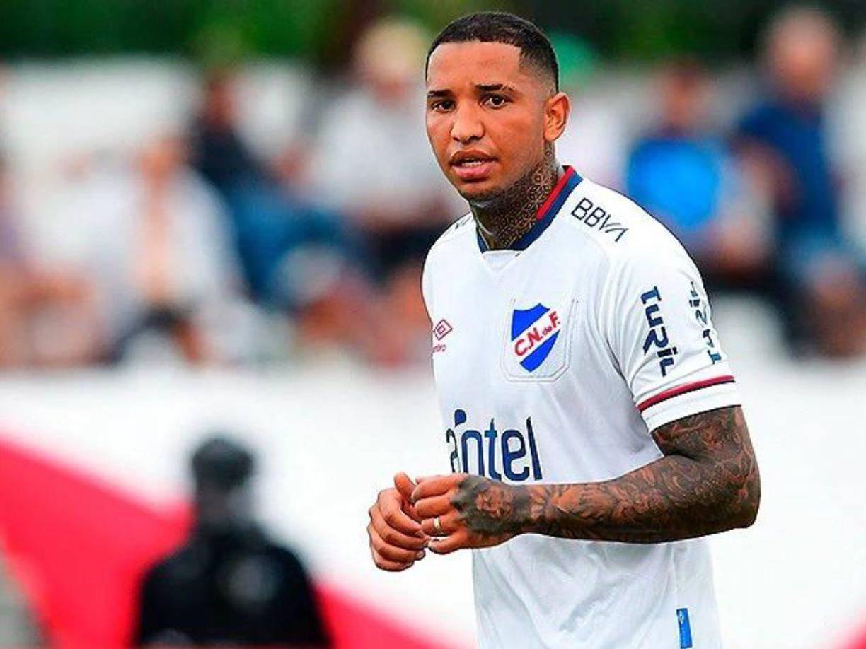 “En el año 2014 se le hizo exámenes al plantel de las formativas de Cerro donde jugaba Juan Izquierdo, y se le hizo un electrocardiograma que dio ese resultado. Tener una arritmia, como muchas veces pasa, no significa que no puede jugar, lo que sí hay que controlarlo y estamos seguros de que los diferentes médicos de los clubes por donde pasó lo han controlado”, comentó el Secretario de Deportes.