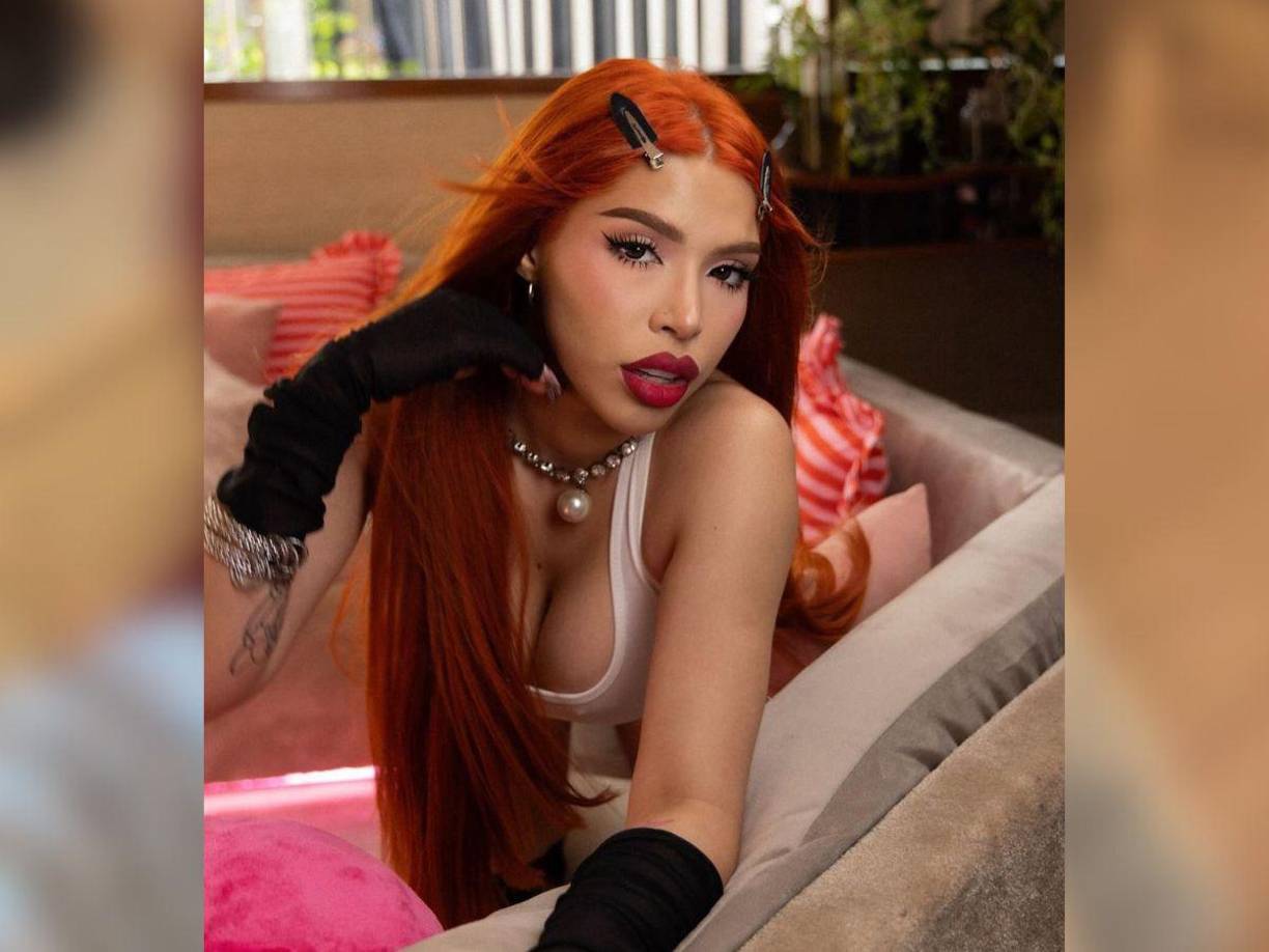 La influencer dio detalles del nuevo procedimiento estético al que se sometió este lunes y que se suma a los cinco que ha tenido desde los 19 años de edad.