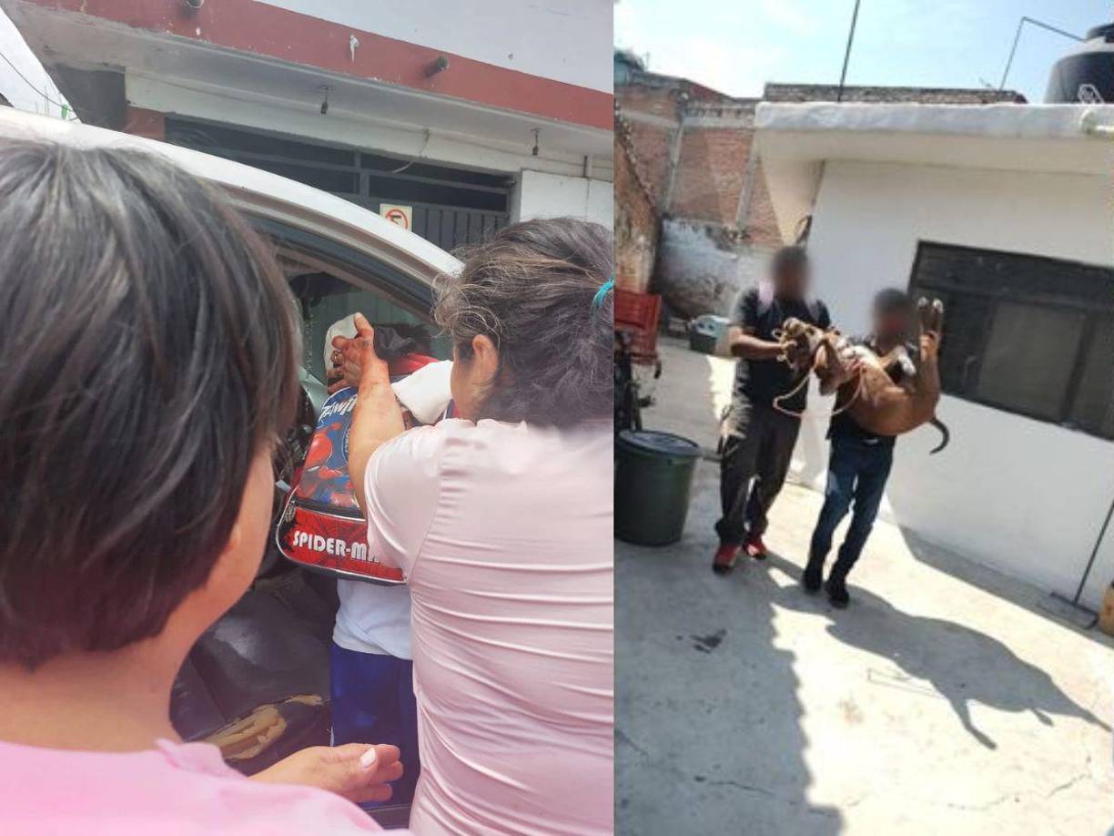 Un niño de cinco años fue atacado por un perro de la raza Pitbull cuando él regresaba de su centro educativo. Según relatos de sus padres el canino le desfiguró su cara.