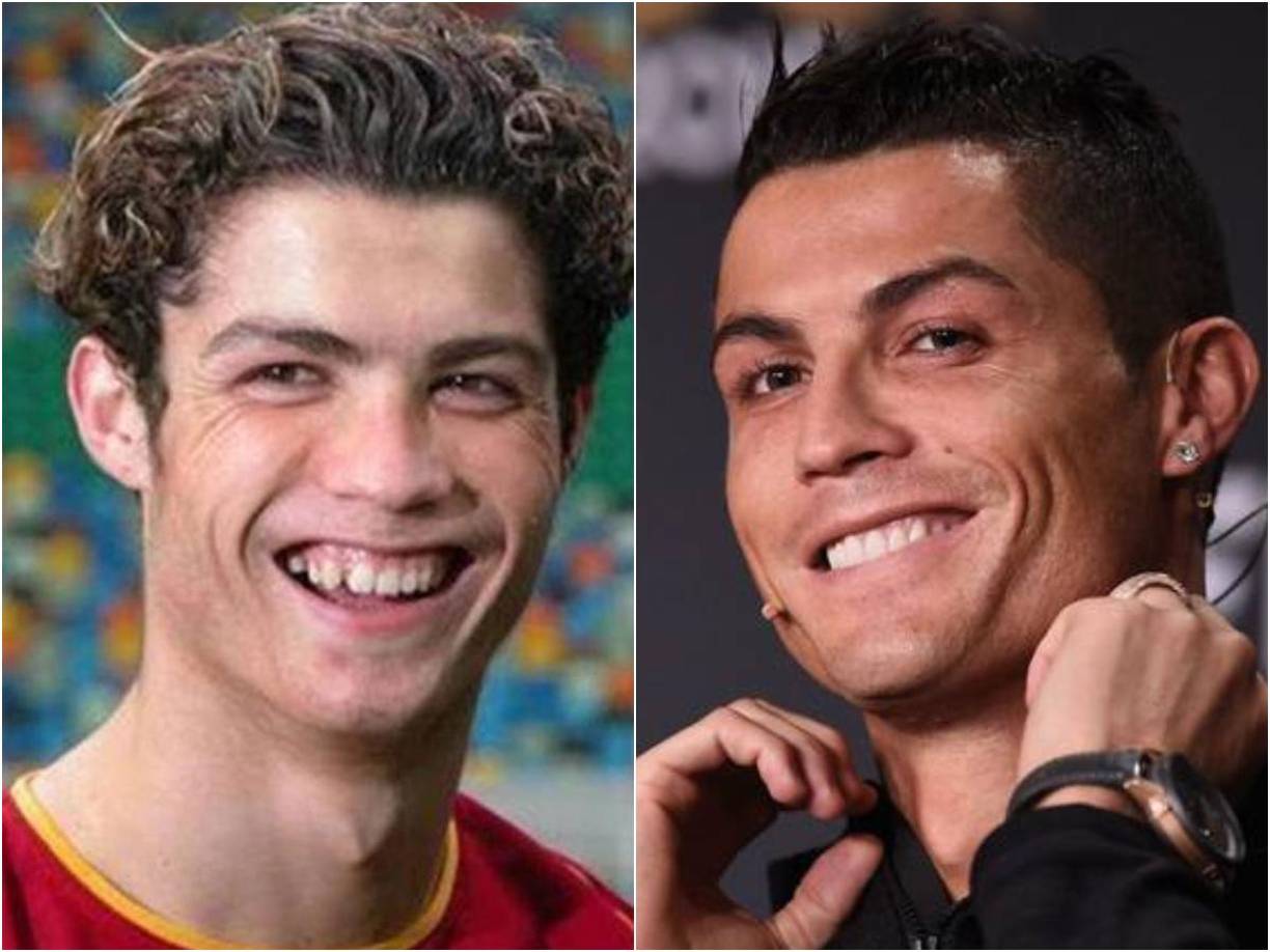 El antes y el después de Cristiano Ronaldo es abismal.