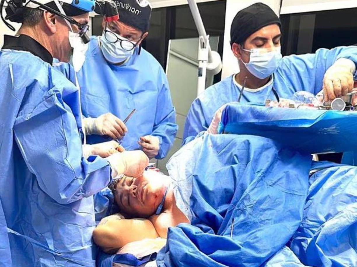 Hace seis días, el autor del tema “Si me pudieras querer” se reportó estable tras salir de la intervención que duró varias horas, sin embargo, después fue reportado delicado tras padecer un desgarre de los divertículos, así lo informó su esposo Roy García.