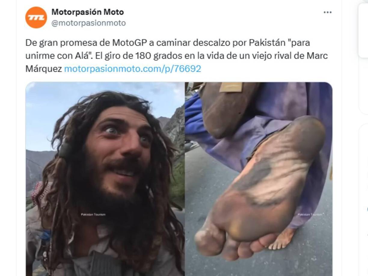 La noticia sobre el enorme cambio del expiloto Axel Pons ha generado repercusión a nivel mundial. 