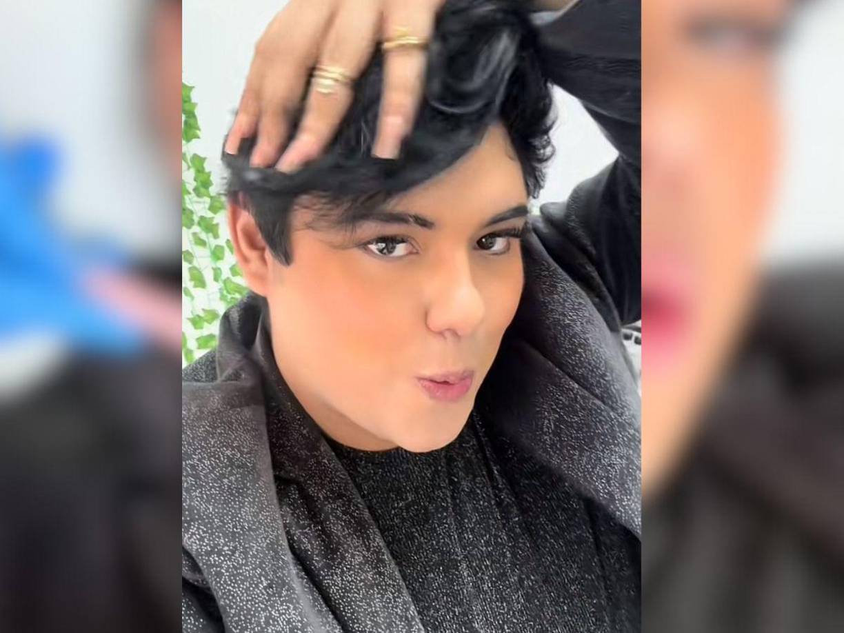 La lipopapada se realiza con la finalidad de dar una apariencia facial más estilizada, juvenil y atractiva.