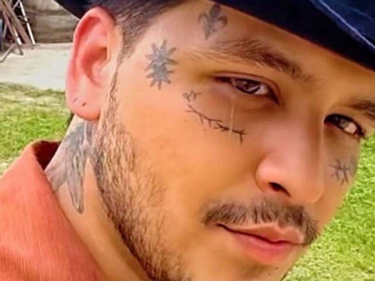 Dejando de lado la complejidad de eliminar sus tatuajes, Christian Nodal también tendrá que lidiar con un gran dolor, principalmente, después de hacerlo.