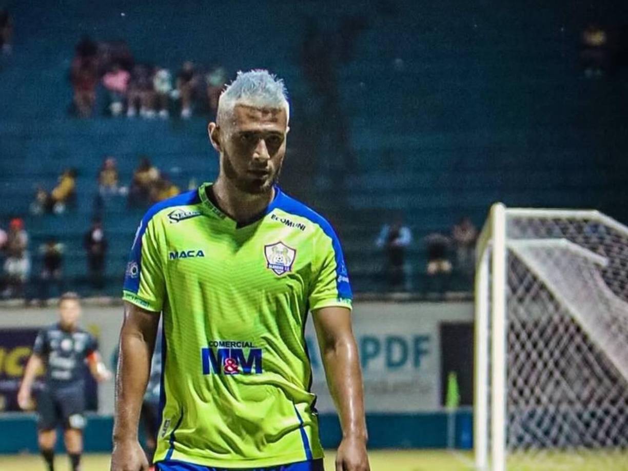 Alexander López: Una lesión con la selección de Honduras lo dejó sin poder tener acción con Potros en la recta final del Apertura 2024. El veterano volante finalizó su contrato con Olancho. 