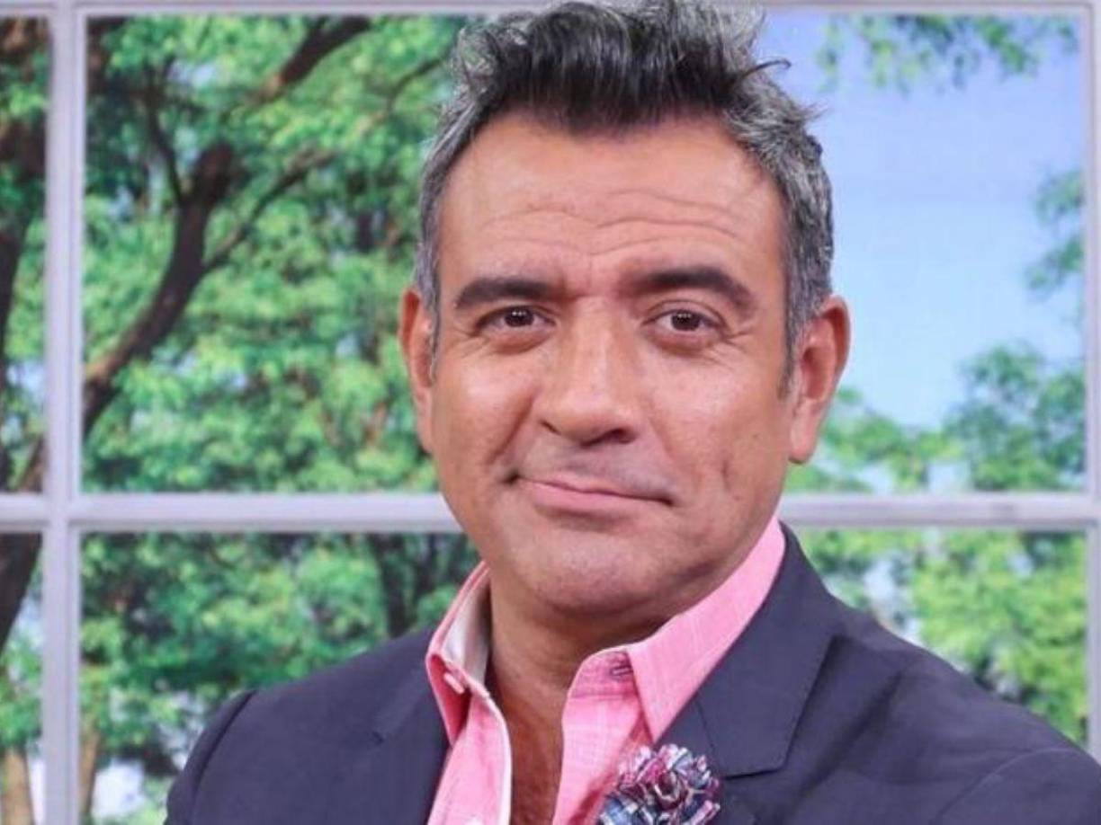 “Me hice una cosa que se llama ritidoplastia cervical extendida, que es la reducción de la papada, y lo otro fue blefaroplastia superior, que es remover el exceso de piel en los párpados superiores”, explicó.