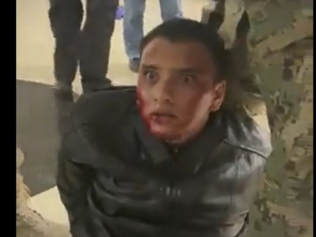 El hombre capturado aparentaba estar bajos los efectos de alguna sustancia.
