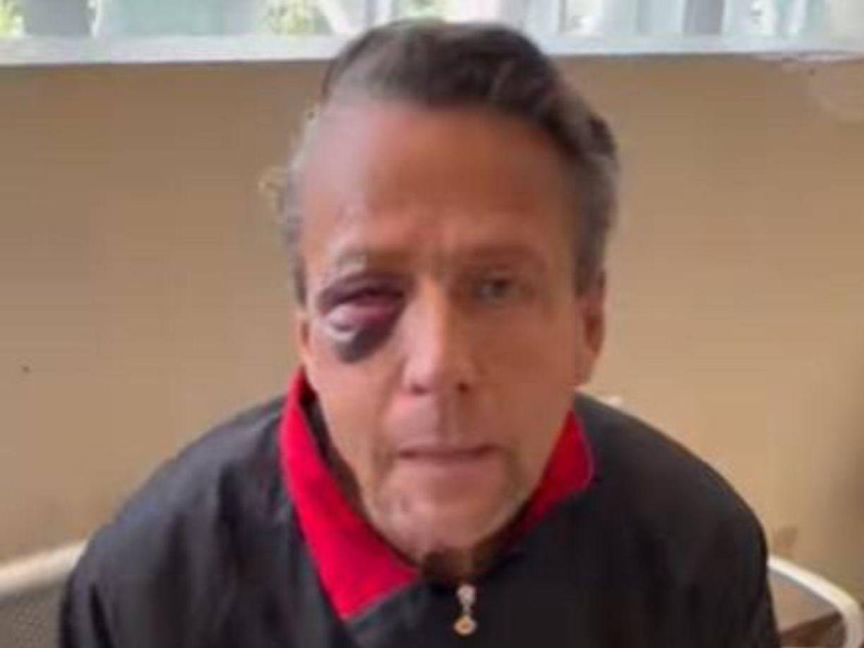 Adame entabló su denuncia contra los hombres, pues le dejaron lesiones en el rostro y en el ojo derecho, y por poco pierde la vista; en noviembre les otorgó el perdón, pues aseguró que no quería ser el culpable de que alguien estuviera en prisión.