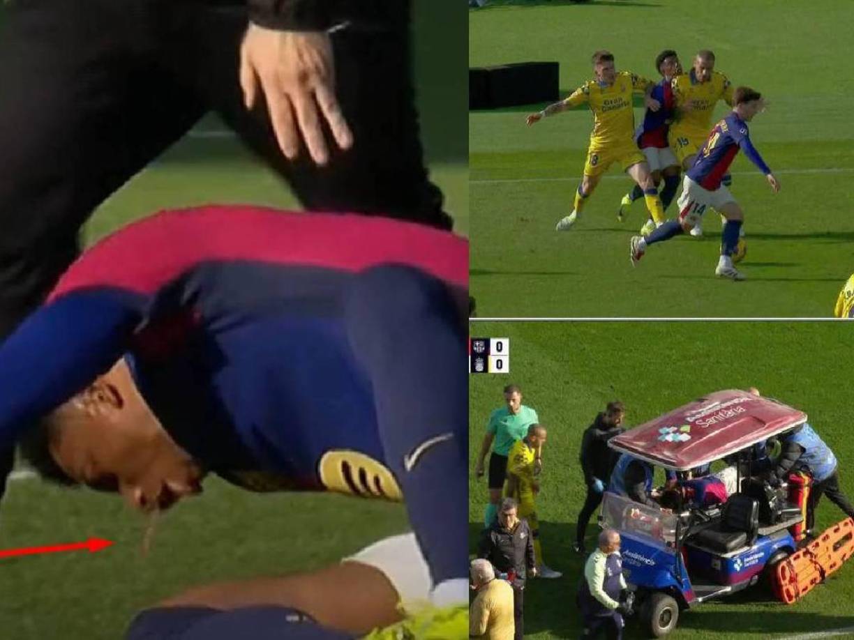 En imágenes que se viralizaron en redes, Alejandro Balde vomitó sangre después del choque con Sandro.