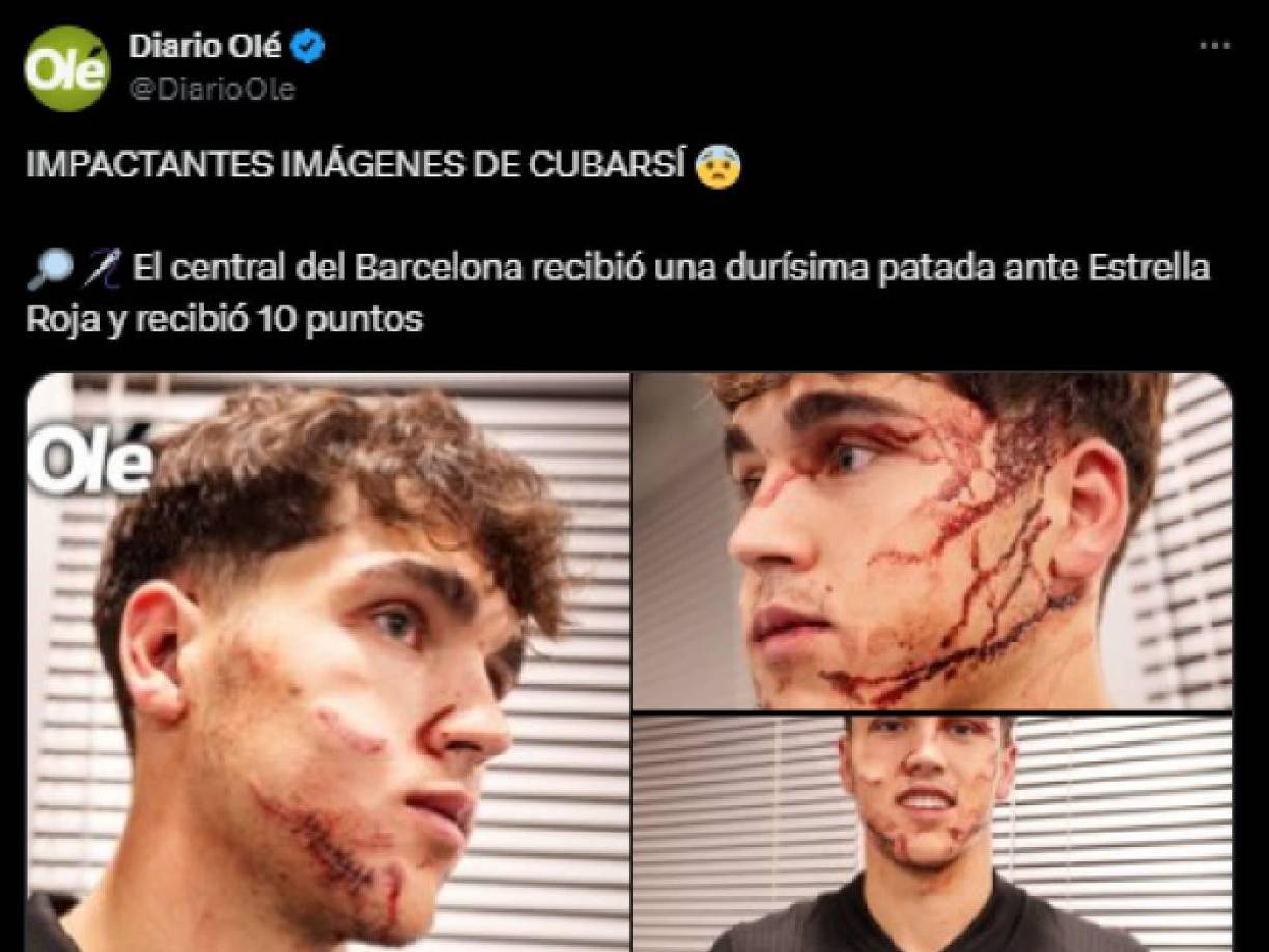 Las imágenes han dejado impactados a medios y seguidores en las redes sociales.