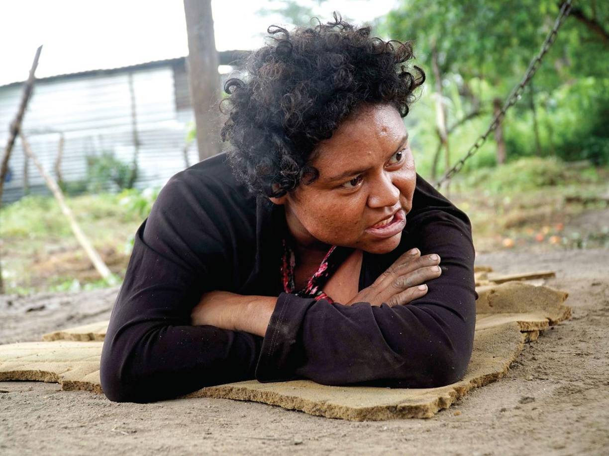 Doña María Elena Guillén tiene tres años de estar sufriendo con su hija Petronila Guillén Méndez a quien se ha visto obligada a encadenar en una galera por su agresividad causada por la demencia que padece.