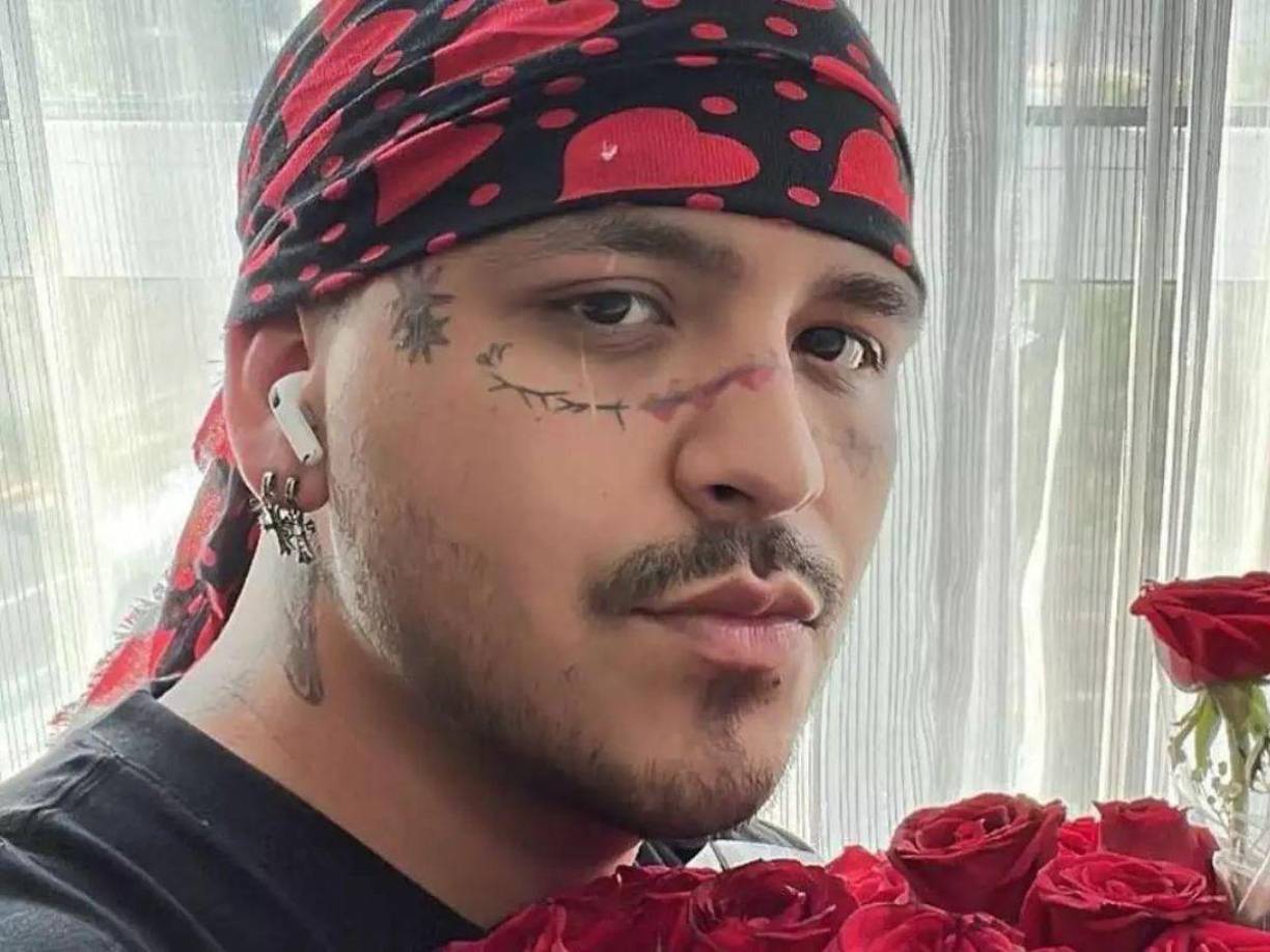 El intérprete de “Vivo en el 6”, “Botella tras botella”, “De los besos que te di”, “Ya no somos ni seremos”, entre otras, ha optado por un costoso tratamiento para quitarse los tatuajes que se hizo en el rostro y los avances son significativos.