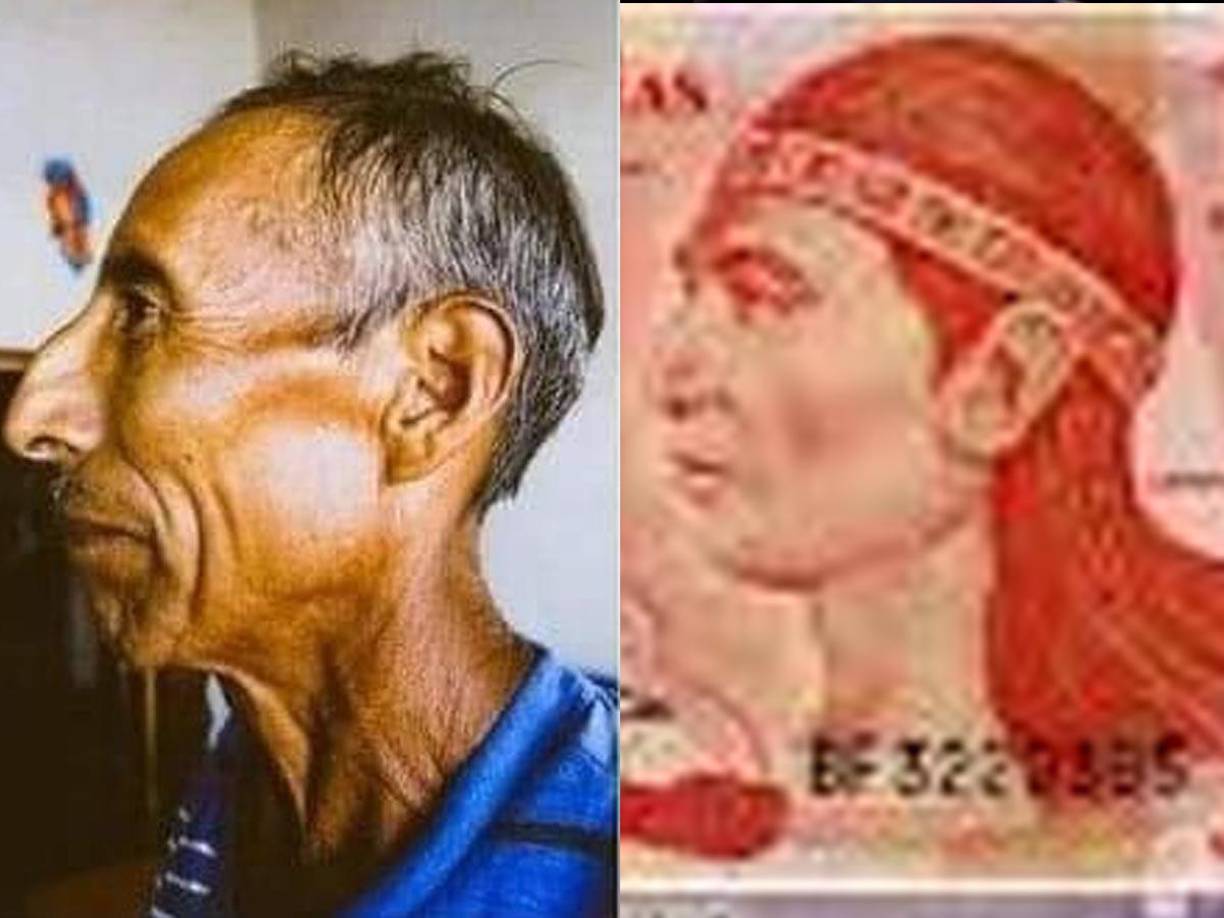 Durante más de 40 años del siglo XX, el billete de un lempira, moneda de Honduras, que en sus mejores tiempos equivalió a 50 centavos de dólar, tuvo el rostro de un indígena, con plumas en la cabeza, que no se parecía a los de los grupos étnicos hondureños, sino a los de tribus de Estados Unidos. EFE