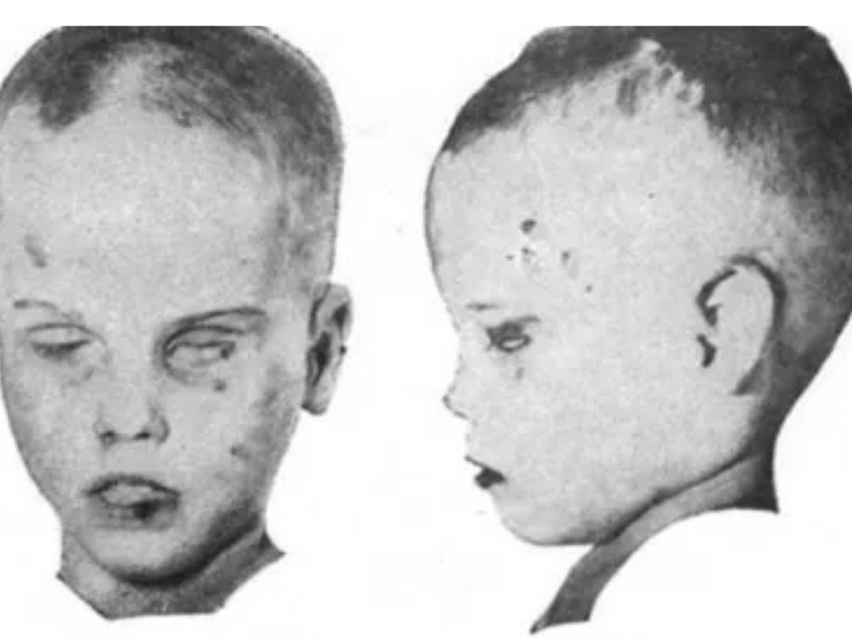 En lo que se conoce como el caso del “Niño en la Caja”, su cuerpo fue descubierto envuelto en una manta dentro de una caja de cartón el 25 de febrero de 1957.