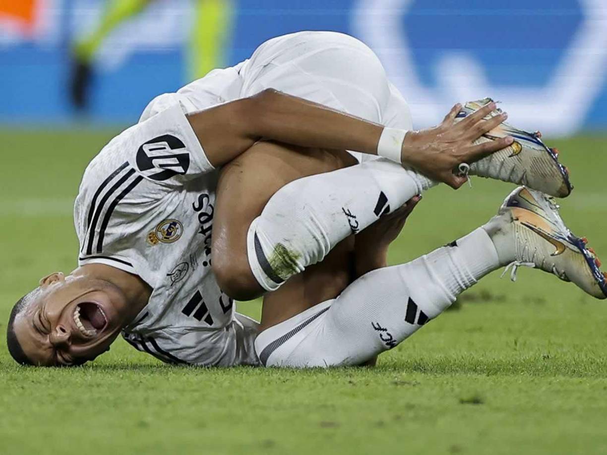 Kylian Mbappé se duele de su tobillo izquierdo tras el pisotón de Jules Koundé. 