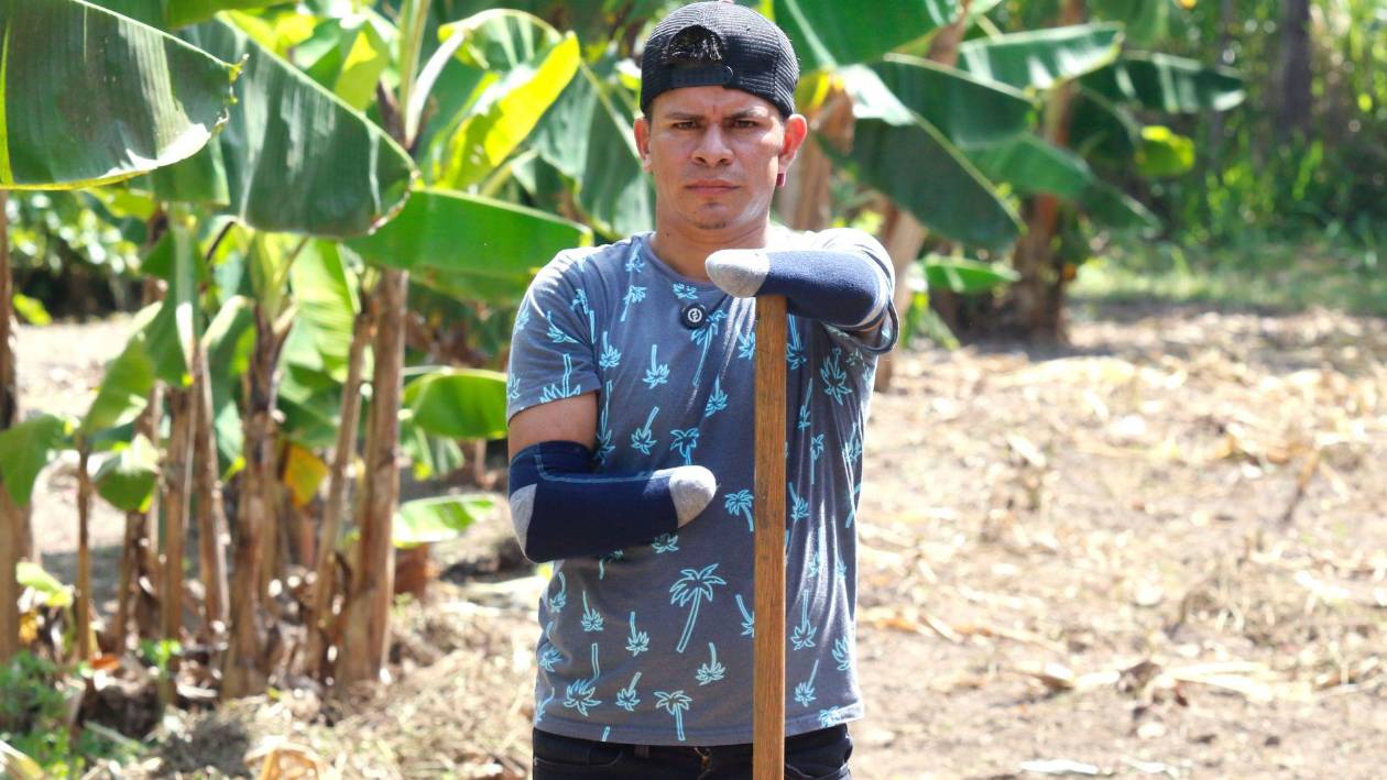 A Santos le cortaron sus manos y ahora inspira a otros: Ya no quiero volver atrás