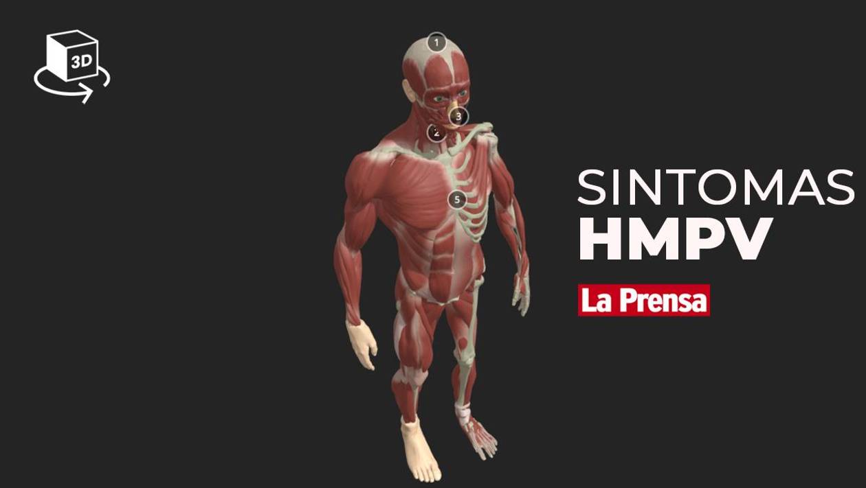 Infografía 3D: Estos son los síntomas del virus HMPV