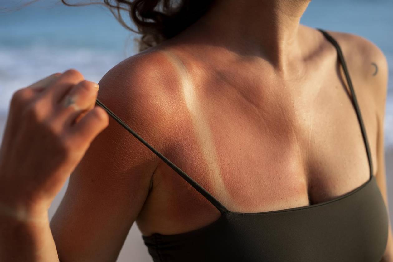 ¿Cómo prolongar el bronceado tras el verano?