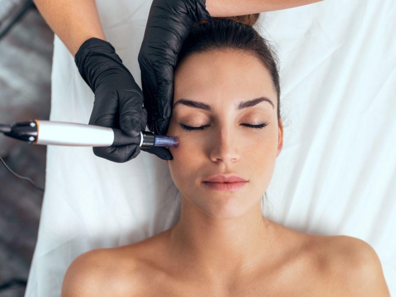 Mesoterapia: el tratamiento corporal que mejora piel y figura