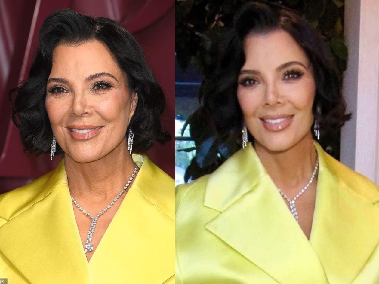 Kris Jenner muestra su rostro tras someterse a cirugía de 100 mil dólares