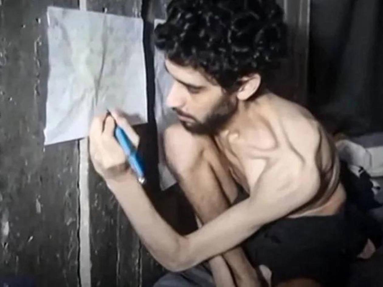 Necesita tratamiento o morirá, dice hermano de rehén de Hamás