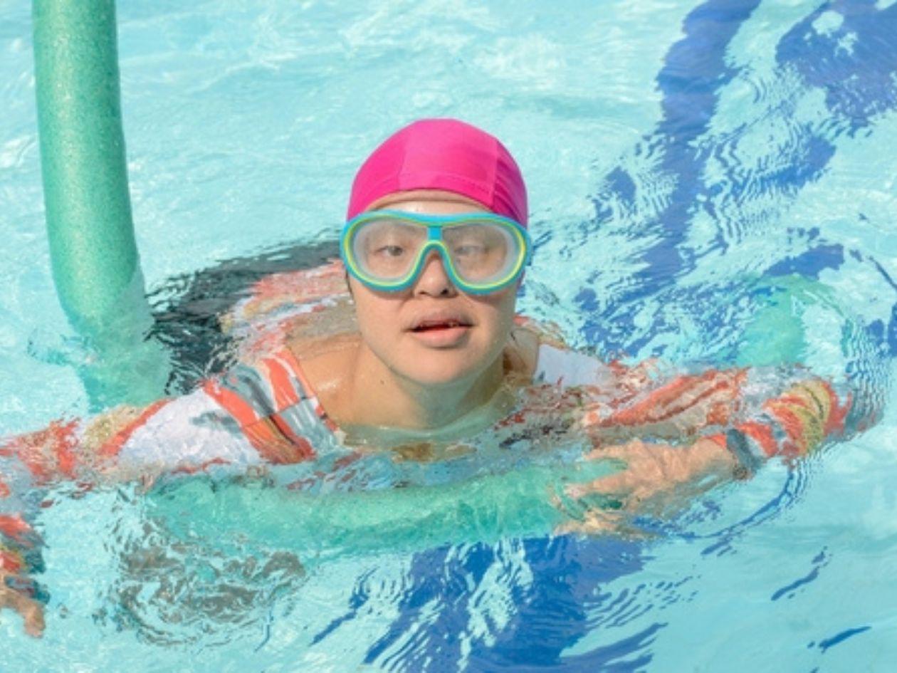 La obesidad en el síndrome de Down es un factor de riesgo para el deterioro cognitivo