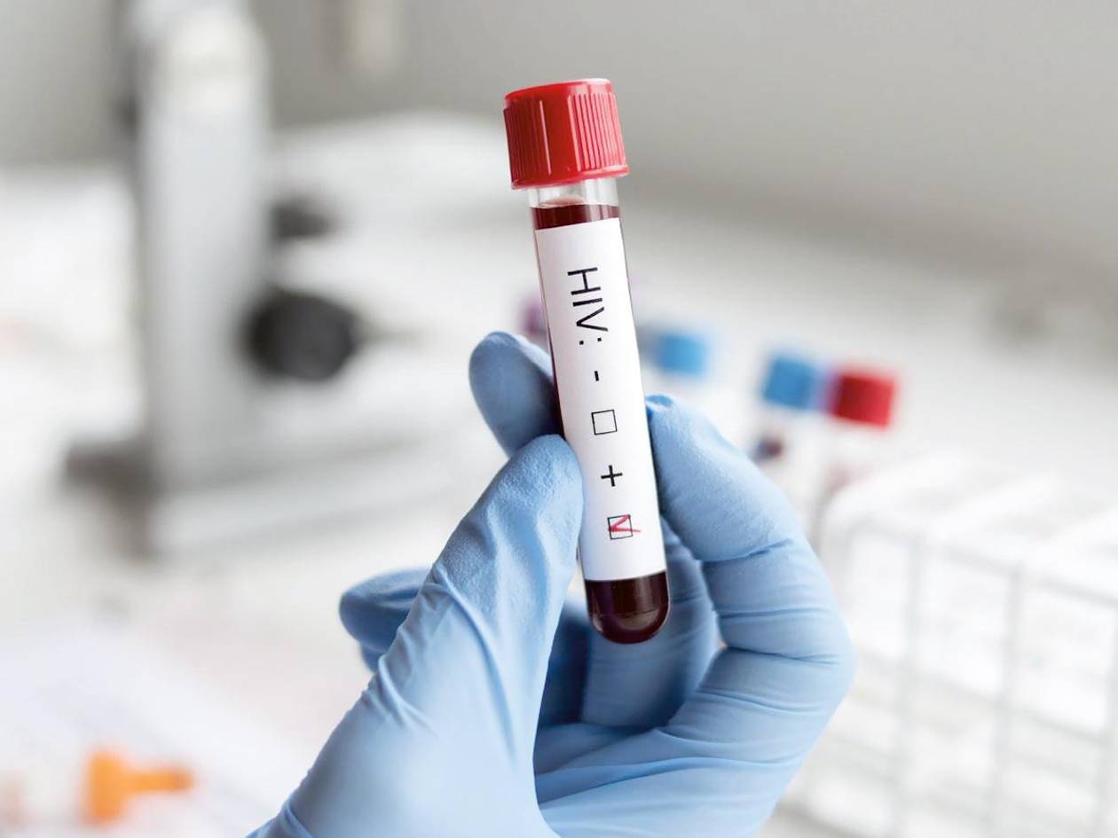 Cortés supera los 15,400 casos de VIH: encabeza estadísticas