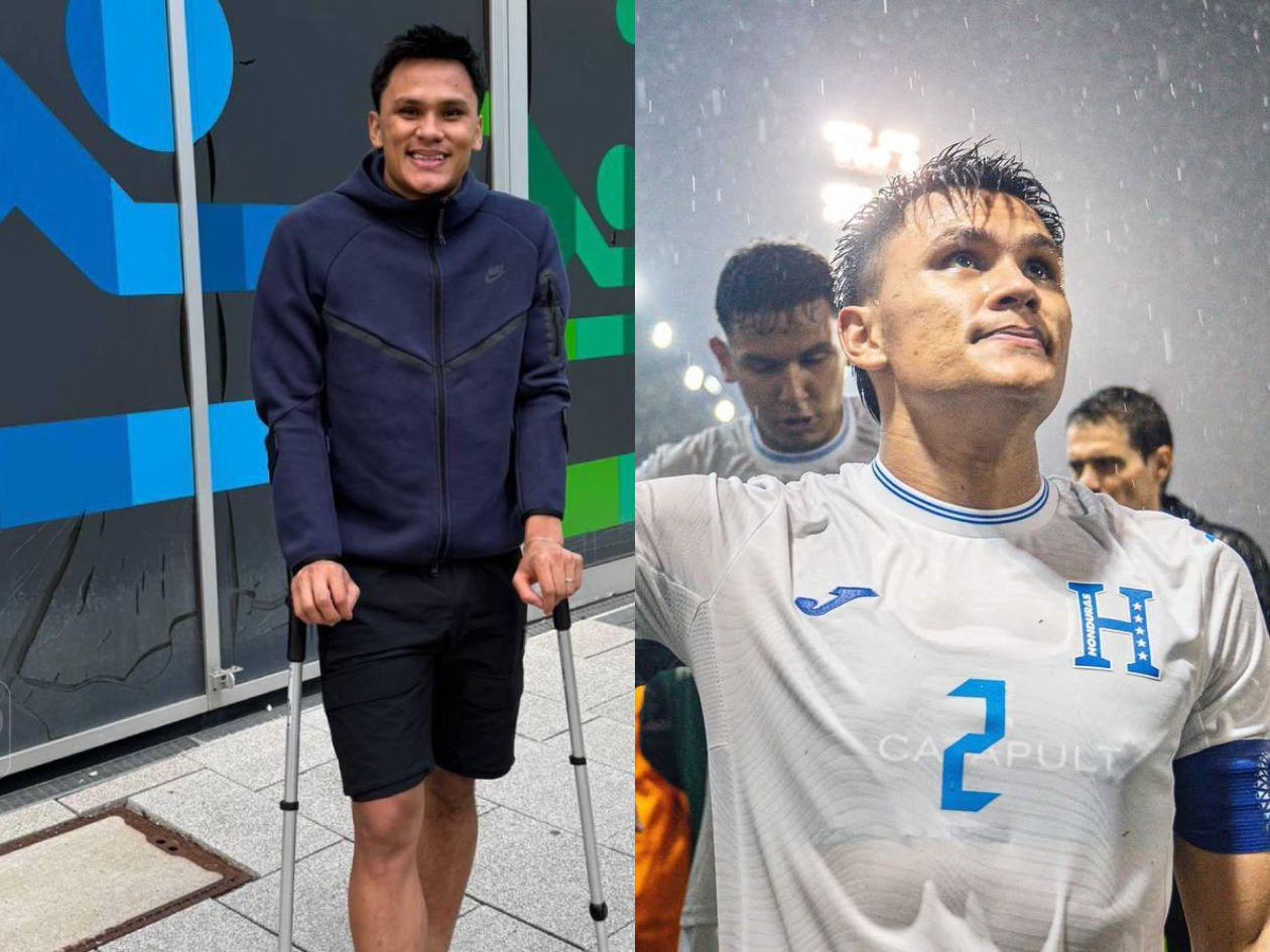 Denil Maldonado revela cómo una maleta perdida lo lesionó