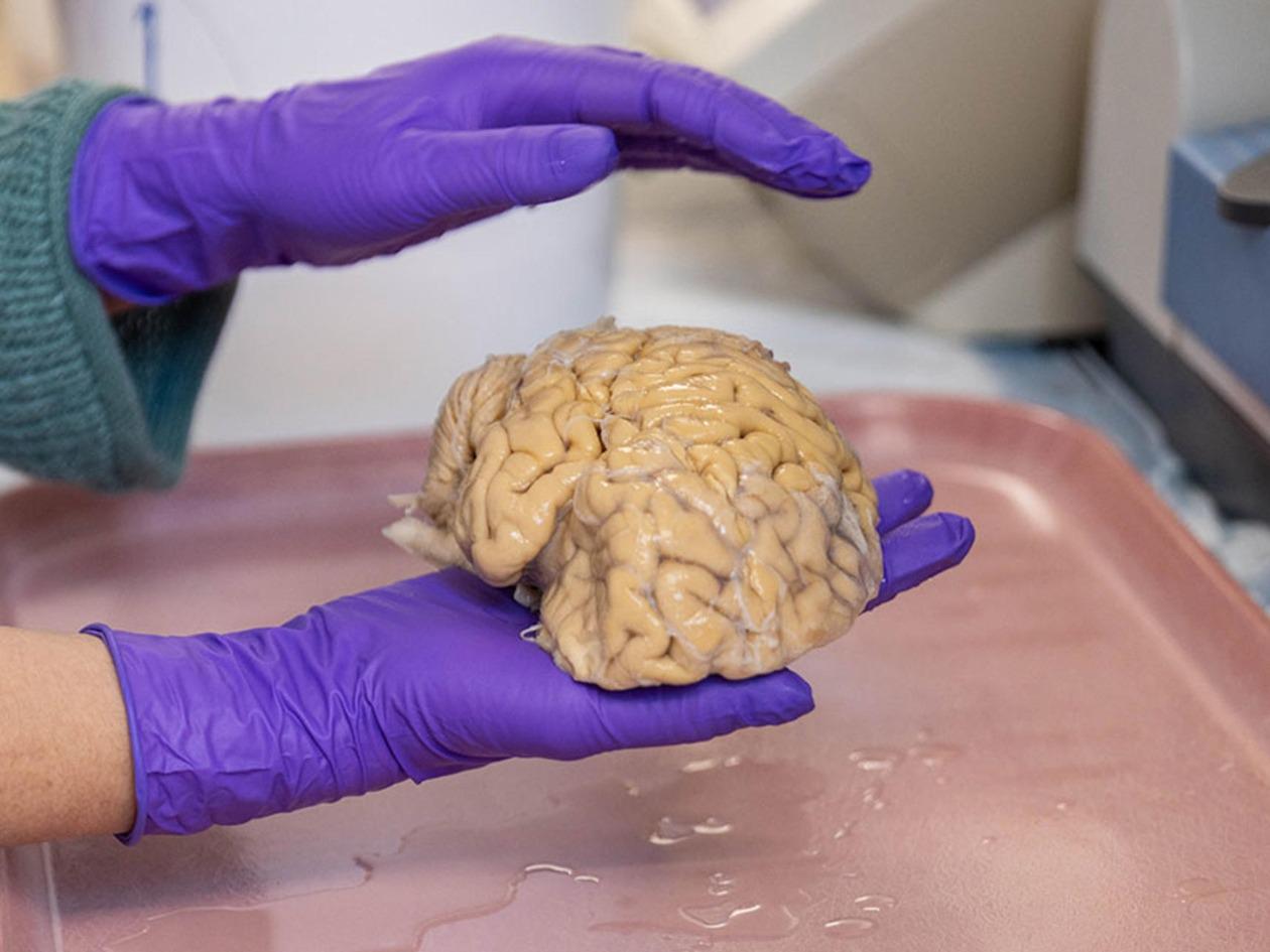 El cerebro de los ‘superancianos’: claves de la eterna juventud