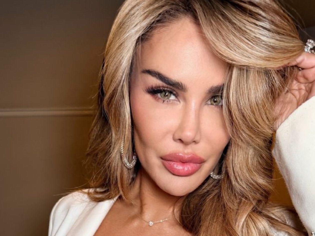 Ninel Conde se somete a costosa cirugía para cambiar el color de sus ojos
